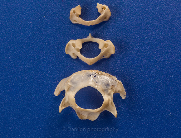 The three vertebrae just behind the skull